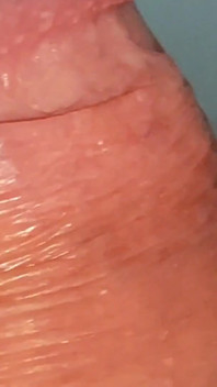 How to Widen a Glans Hole to the Extreme.