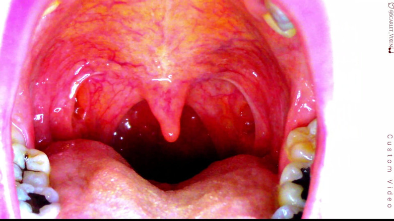Scarlet Vixen: Seksowna Scarlet Says Ahhh - Uvula Showoff