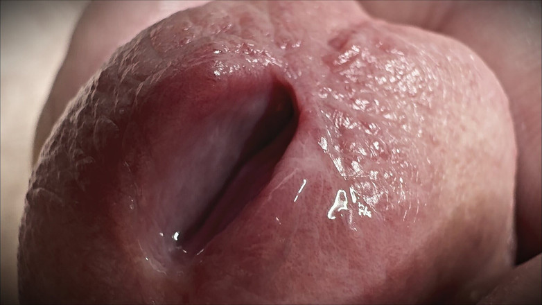 Leonardo-1974: Thâm nhập của lỗ đi tiểu