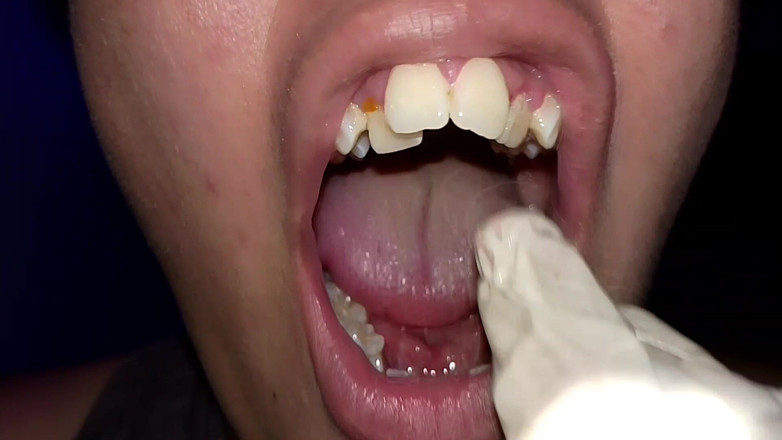 Elimoon: Mencoba Menggunakan Benang Gigi (close-up)