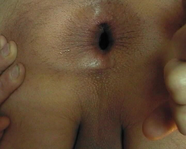 Asshole therapy: Aws49 - menghisap udara ke dalam dubur