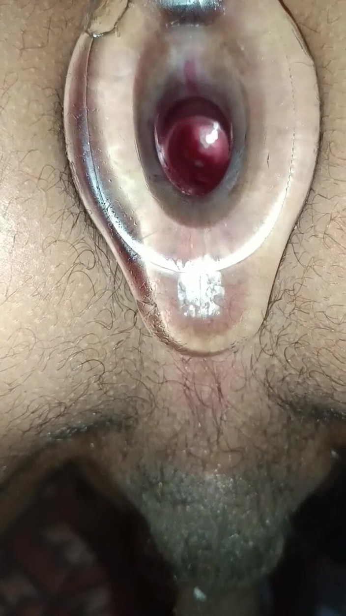 MiguellTrajano: 내 엉덩이가 지금 뜨거워