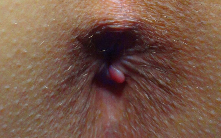 Lala Licious: После свечения