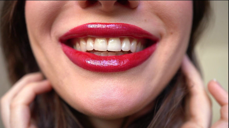 Rarible Diamond: 公主ruby Kiss