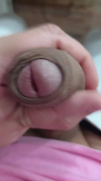 The Head of My Penis