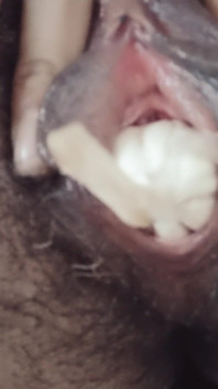 Chlupatý