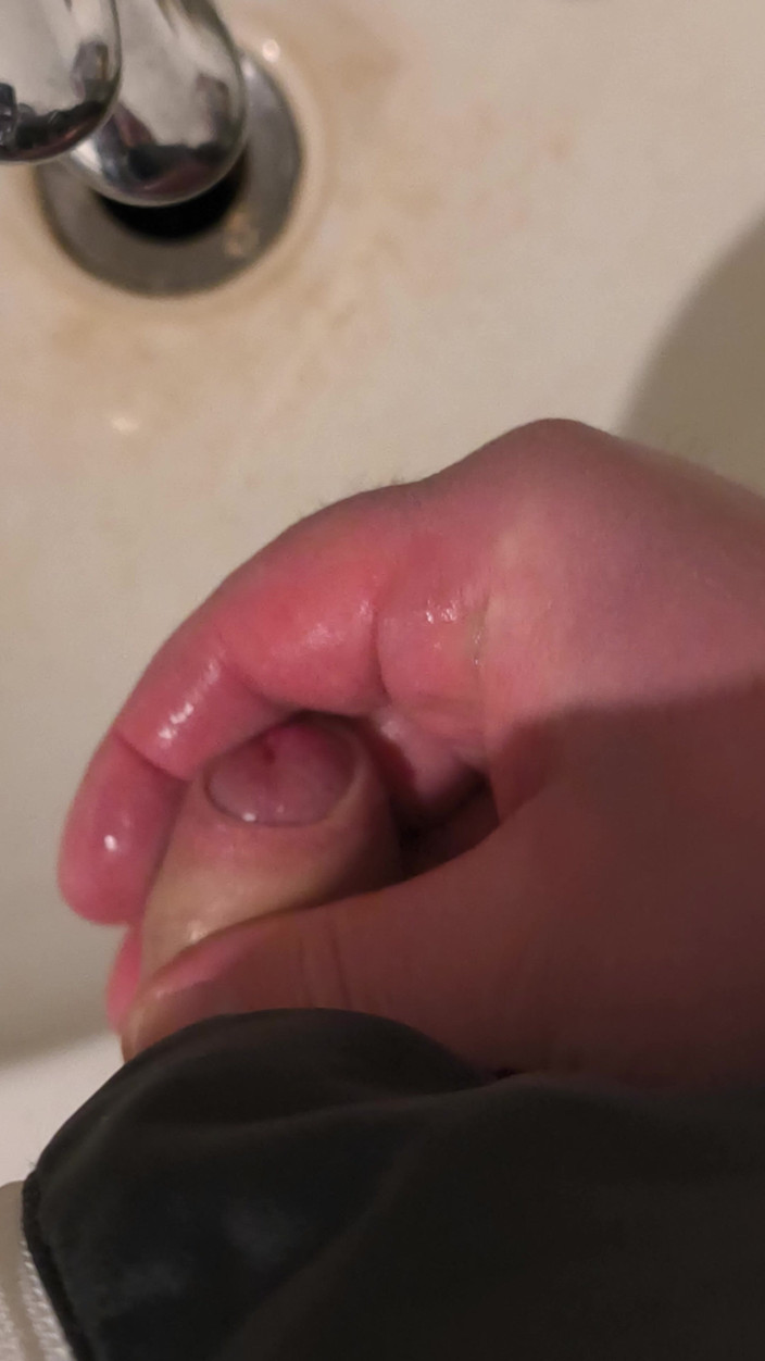 Uglydick: Everywhere