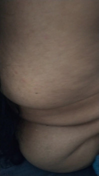 Hot Hip