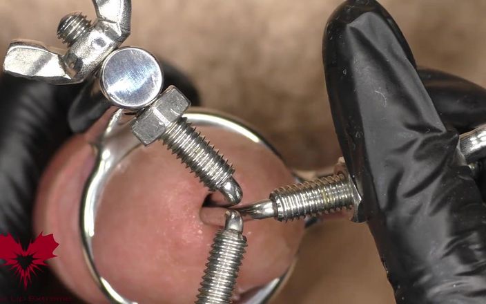 Close Up Extreme: Zblízka aplikace trojka Urethral Stretcher. dilatátor je zvyklý na předtažení