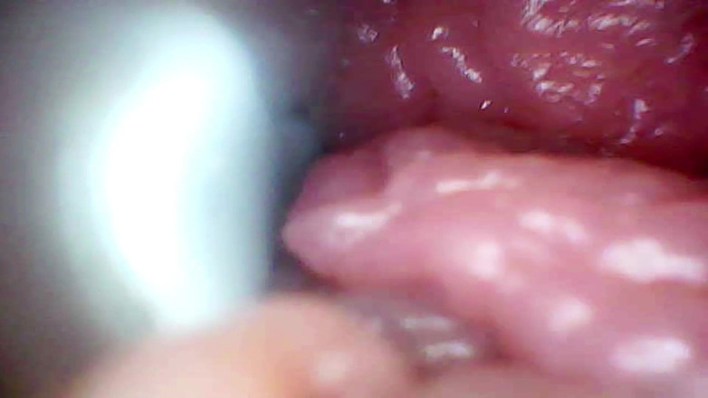 Ladybottox: Endoscope Camera Records My Wife's G Spot. Educational Video Close...