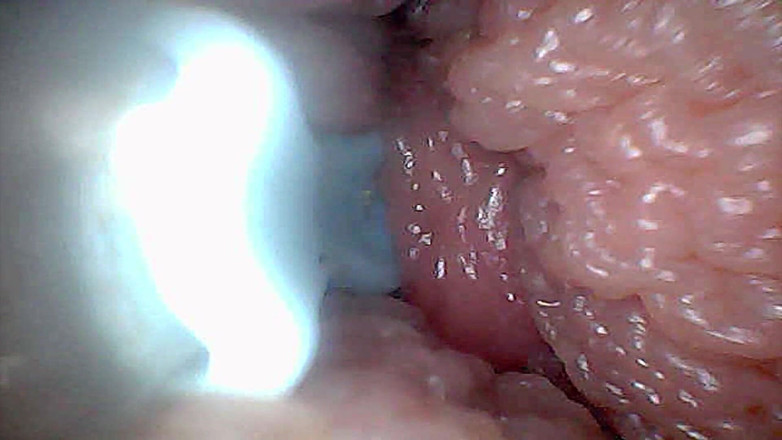Ladybottox: Visual Guide to G-spot Stimulation and Orgasm Endoscop Perspective