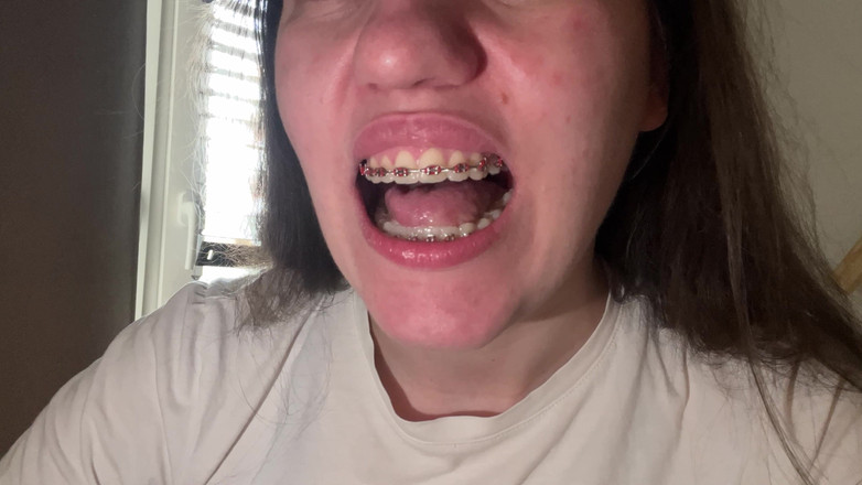 NicoleRay: Dilinizle diş teli yalamak