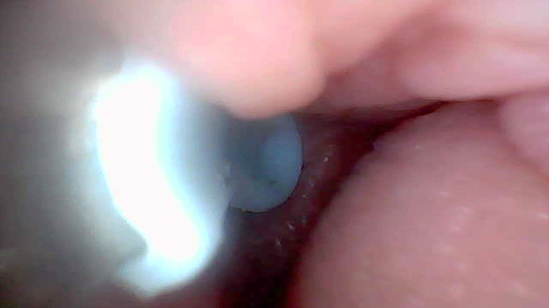 Twittiy: Yuk, Intip Memek Becekku Bareng-bareng (kamera Endoskopi)