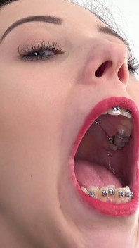Mouth fetish video with Bara showing dental braces.