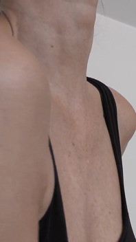 Scars on My Upper Arm, Lady Victoria Valente