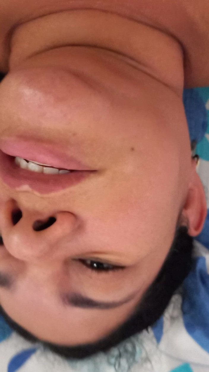 Valkyrie and Luigy Couple: 24. 프로바이오틱스가 풍부한 건강한 스낵 Valkyrie용 우유 요구르트