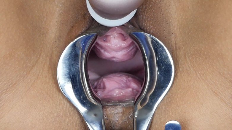SexyThai1987: Speculum - have a look deep inside me