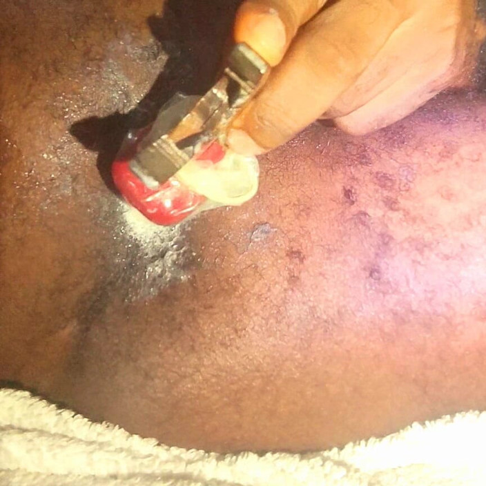 Lyke: Iyke740 Part 1 of My Hairy Asshole Disvirgined