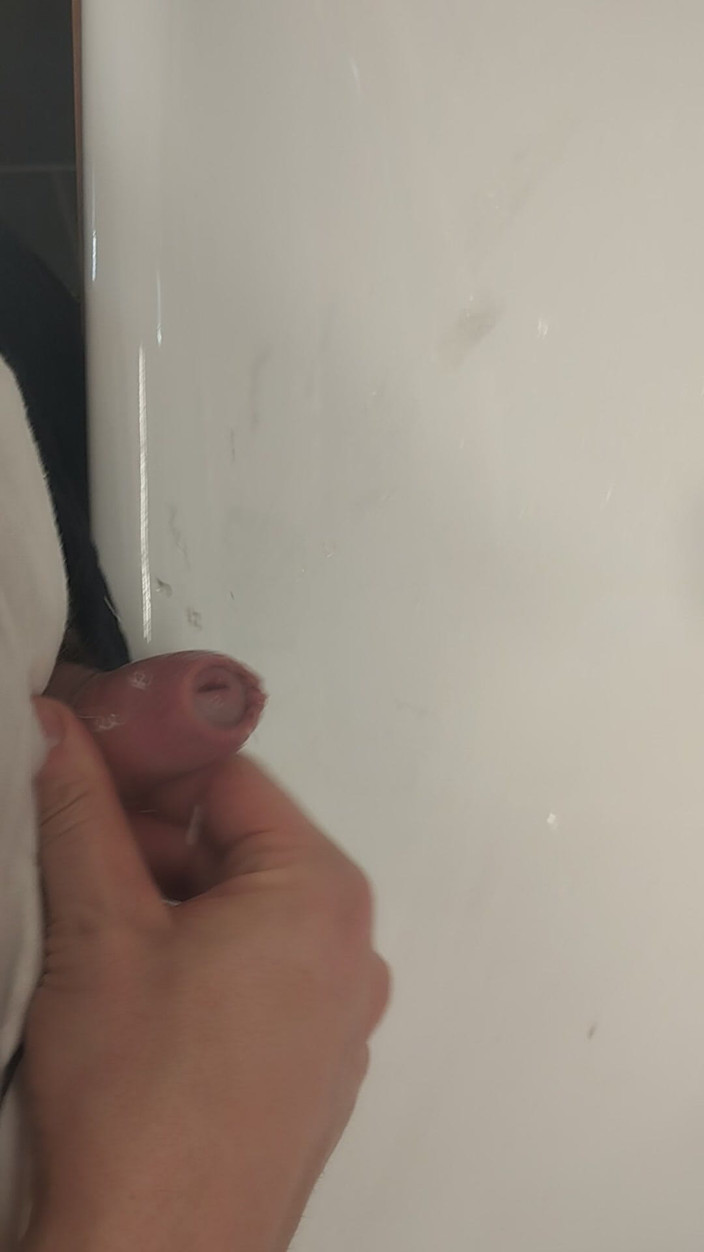 Bayer911: Xixi pequeno depois de 10 km