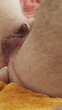 Filling the Hole