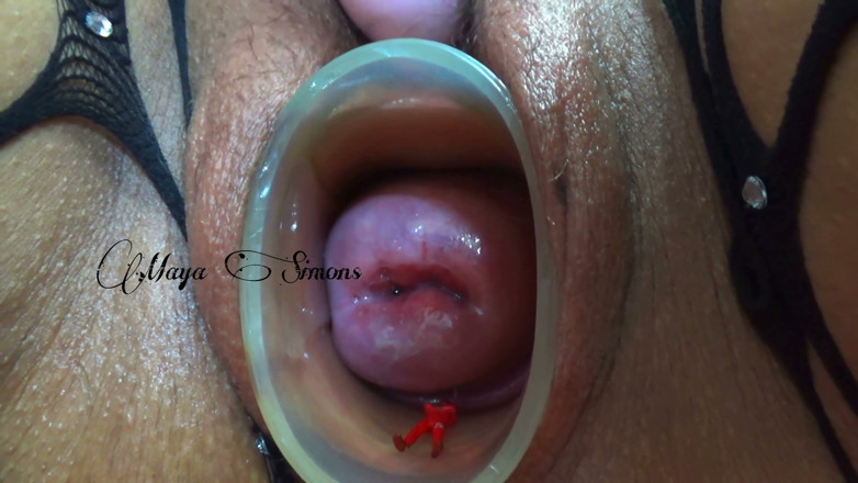 Maya Simons: This Is What My Cervix Looks Like After a Year...