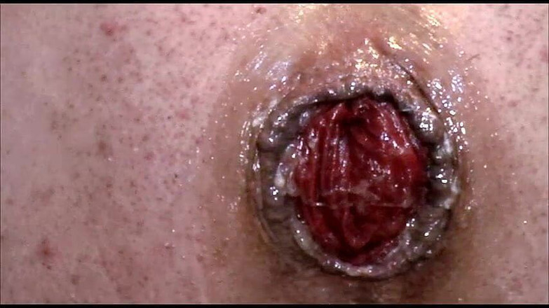 Anita Cocks: विशाल गुदा आगे को बढ़ाव पम्पिंग 20m