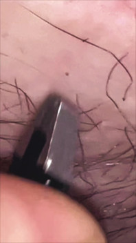 Tweezer Sesh