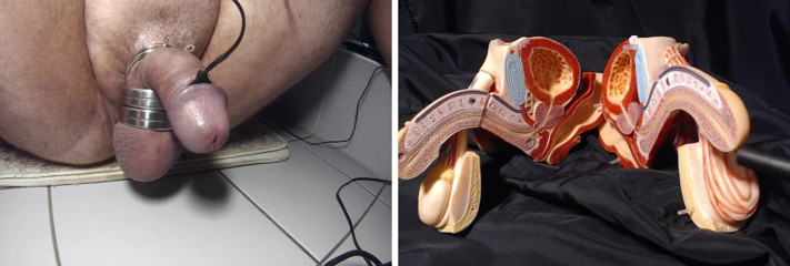Gaylectrician: Male sexual resonse 221216