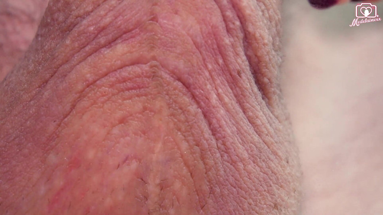 Medi Voi: Pencetus Kamera POV