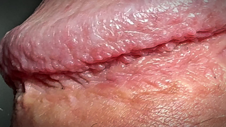 Leonardo-1974: Sikanie na jądra