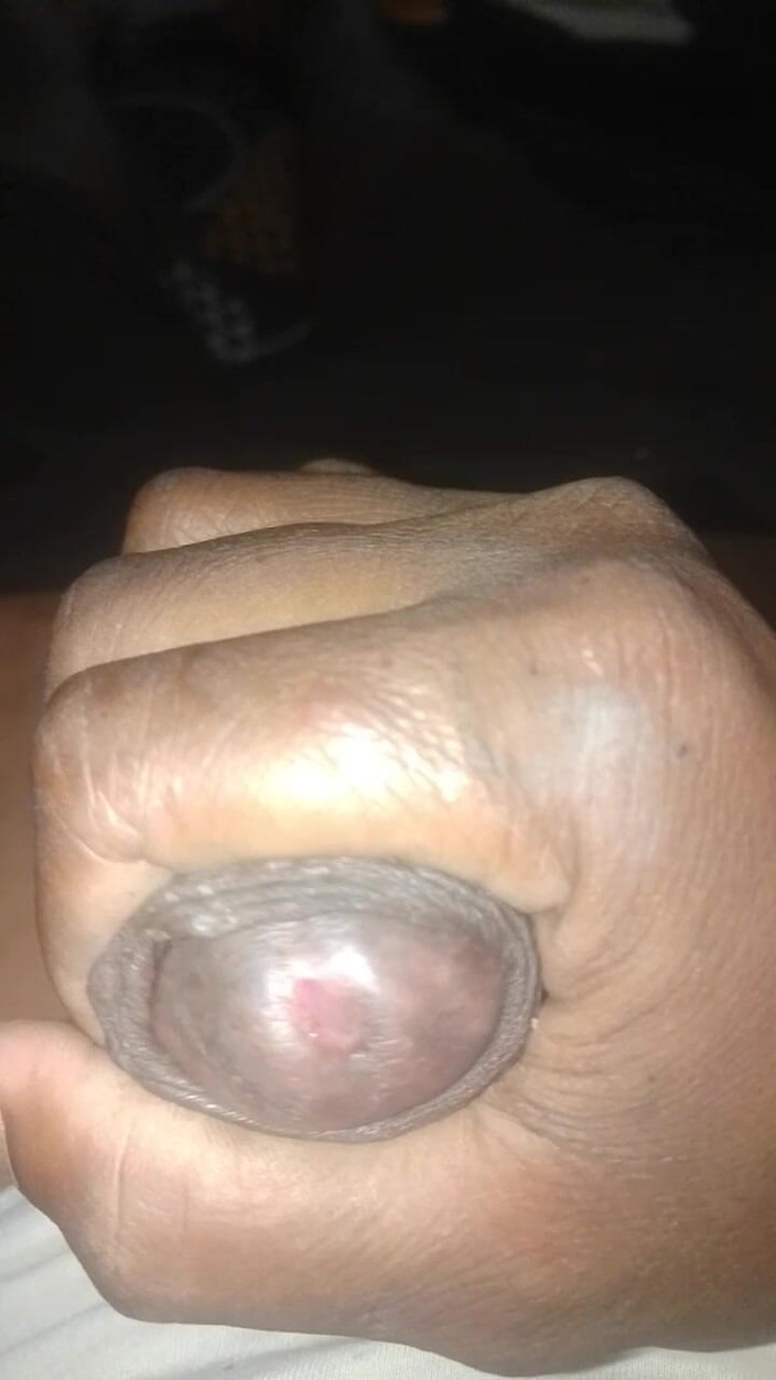 Sex 93: Te fute tare