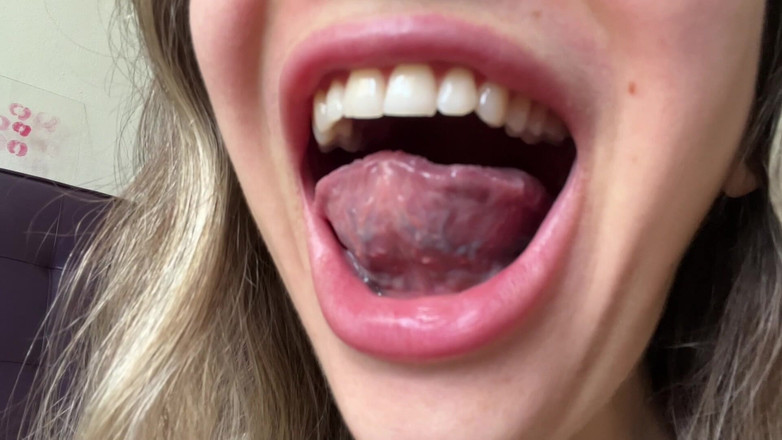 Rarible Diamond: Obryně