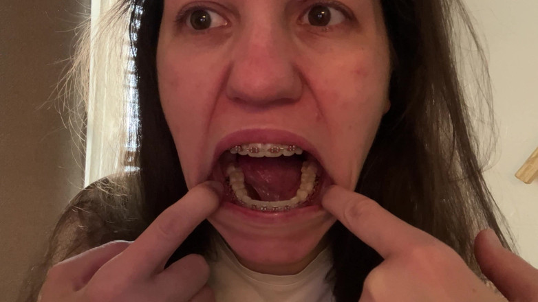 NicoleRay: Lamer los brackets con la lengua