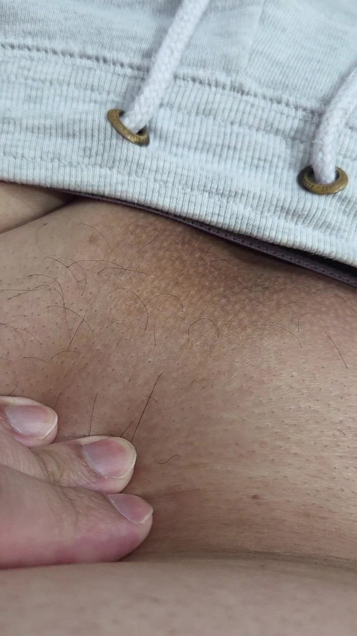 Lkdick8: Rambut Di Penis Saya - Led Hair Removal