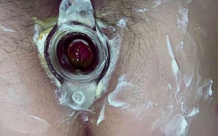 Anal stepmom Mary Di: Hot Anal gaping &amp;amp; tunnel plug. Hairy cunt &amp;amp; asshole close-up