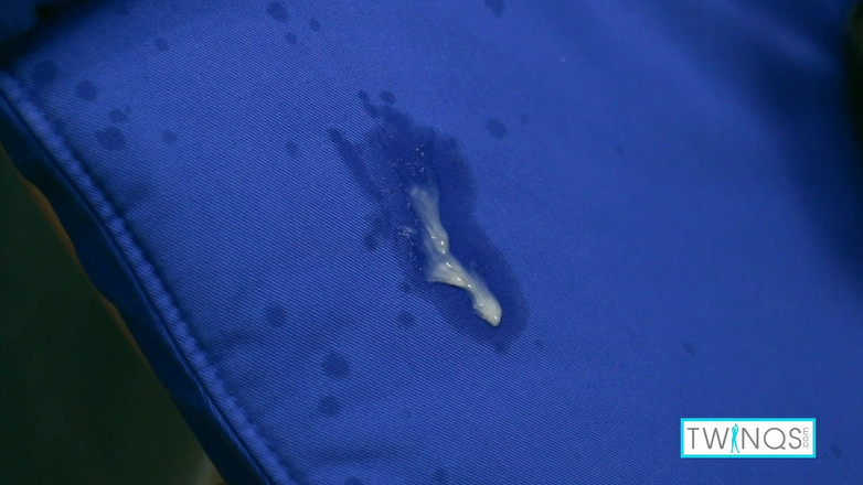 Twin Qs: Jacob bôi dầu lên cậu bé bị xé toạc vuốt...