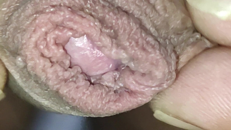 Rock F hairy: Увеличить - приблизиться