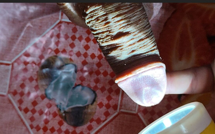 Straight Daddy Club: Ung pappa får sin skrynkliga kuk röntgad.