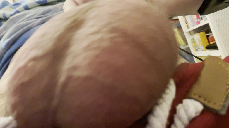 Aimeronds: Tunjukkan Gigitan Dan Puting