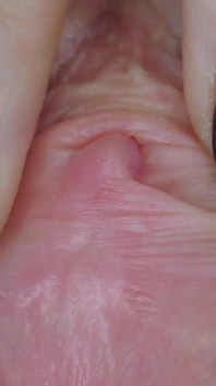 Clitoris and Vagina