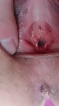 My Pussy Being Fingered in The Yard - Close Up