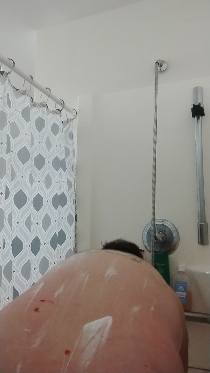 JG Risk: 1-24-2026 Rasage de la jambe de l’autre