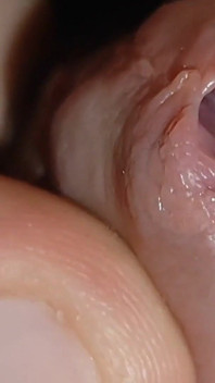 Amazing Glans with Two Cum Holes.