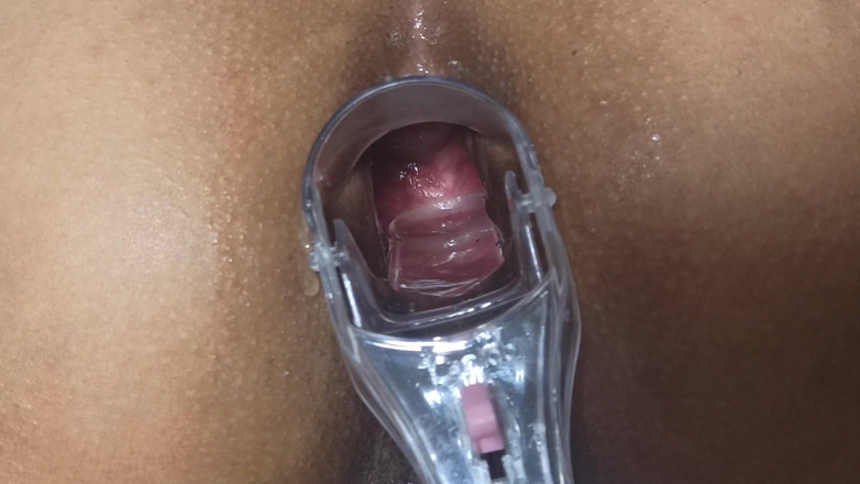 Xamy_97: Speculum in my anus part 1