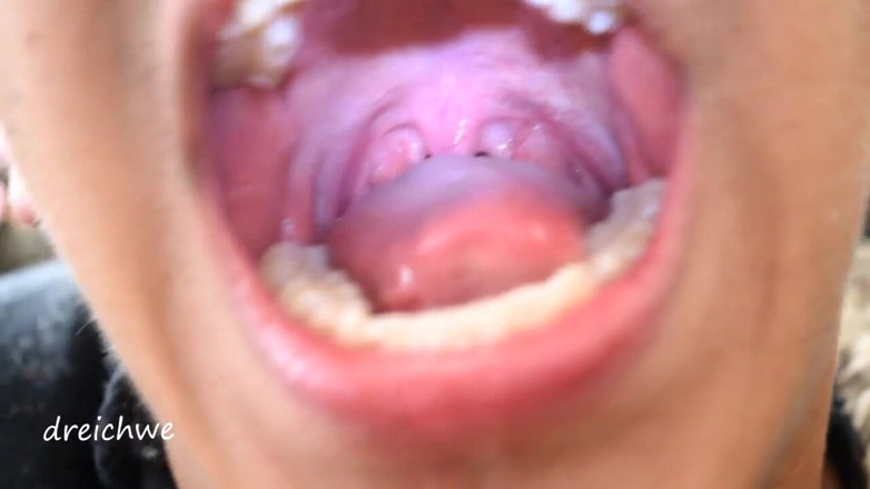 Dreichwe: Uvula fetish mouth