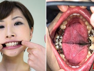Japan Fetish Fusion: Teeth Inspection Chronicles: Dive Into Yua Hidaka&#039;s Enigmatic Oral Realm