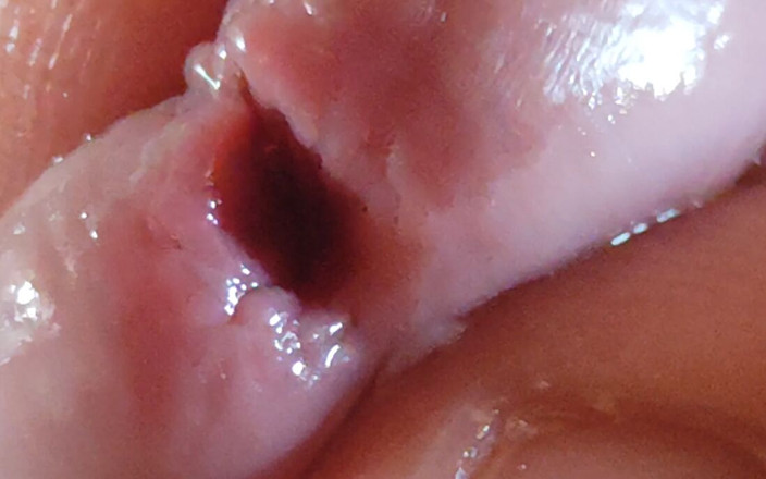 DaddyDoted: Dilation of the Glans Eye Has a Pleasant Surprise.