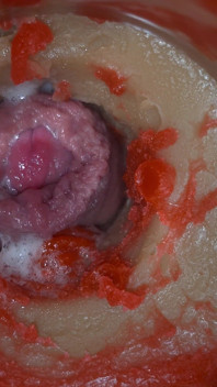 Insemination - Internal Camera Captures Deep Male Ejaculation