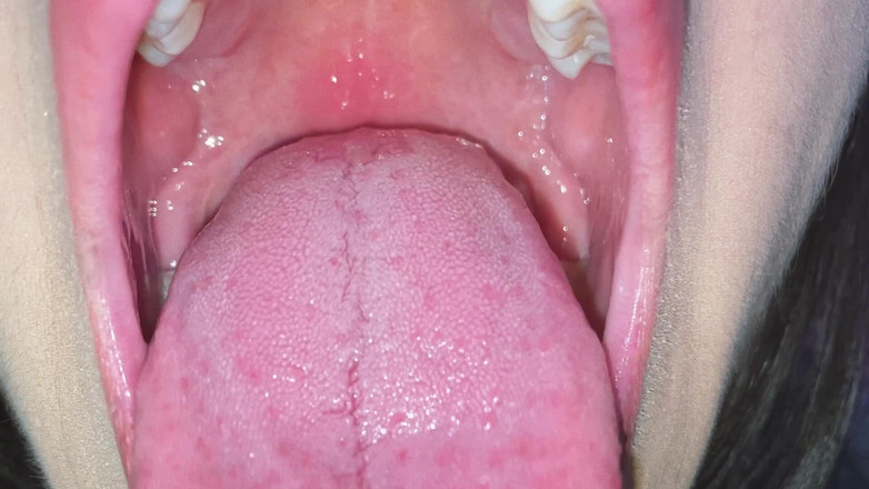 CoralTrip: Голоден