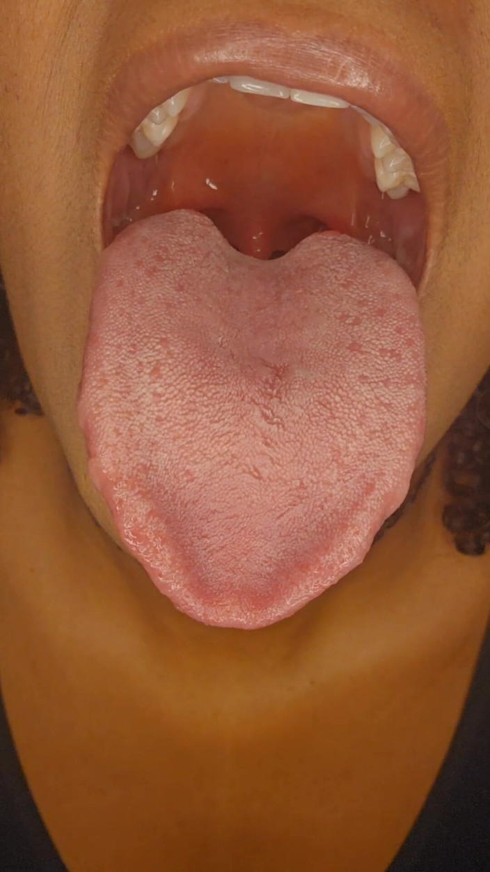 Bunnii: 舌头挑逗喜悦